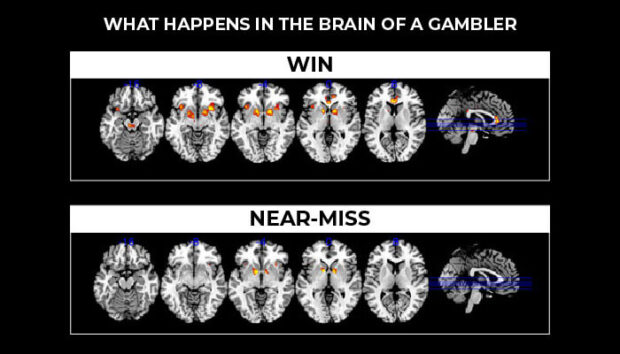 How Does a Gambling Affect Your Brain? How Does a Gambling Affect Your Brain?
